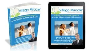 Vitiligo Miracle Book Review