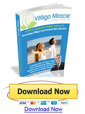 vitiligo miracle book download promoted vitiligo permanently