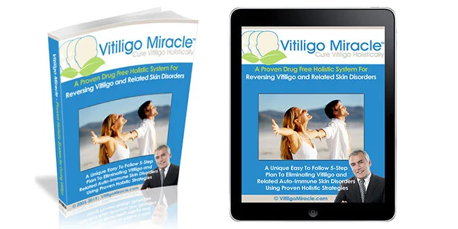 Vitiligo Miracle Book Review
